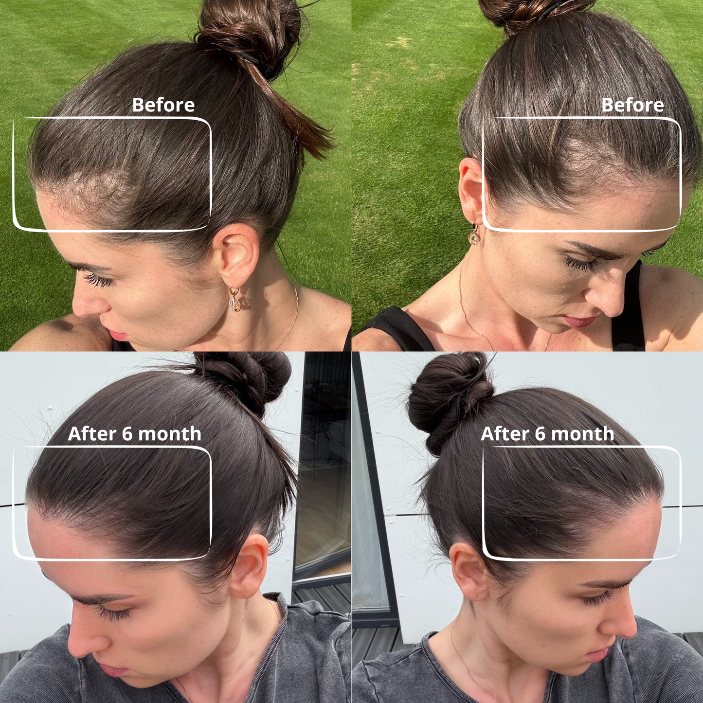 Matu augšanas serums 100 ml